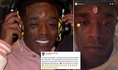 Rapper Lil Uzi Vert Gets 11 Karat Pink Diamond Worth Upwards Of 24million Pierced To His