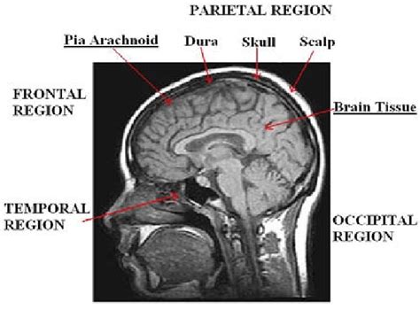 Anatomy Of Human Head Sagittal Section Download Scientific Diagram