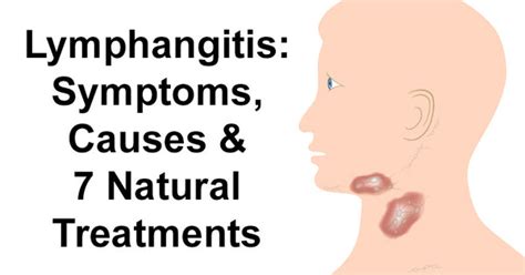 Lymphangitis Symptoms Causes And 7 Natural Treatments David Wolfe Shop