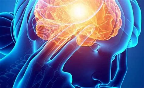 Antara tanda awal terkena strok haba ialah sakit kepala berdenyut, mual, kurang berpeluh walaupun dalam suhu panas dan denyutan nadi yang pantas. Sebelah Wajah Terasa Kejang? Kenali Tanda-Tanda Awal ...