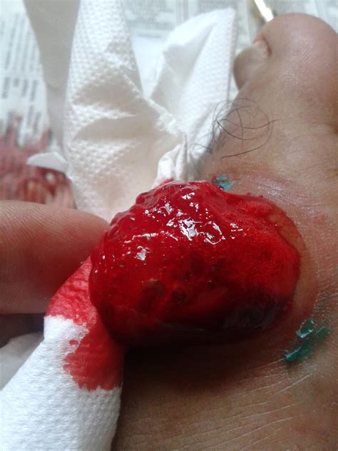 Simak beragam penyebab telapak kaki sakit dan cara lalu angkat kaki kanan ke atas dan letakkan di paha kiri anda. Rawatan Islam Jengka (RIJ): Merawat Sakit Gout dengan Berbekam