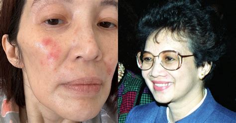 kris aquino calls on mom cory for courage amid health condition philstar life