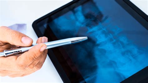 Why X Ray Imaging Is Crucial For Chiropractors