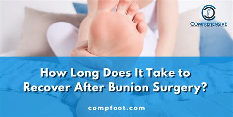 How Long Does It Take To Recover After Bunion Surgery Comprehensive