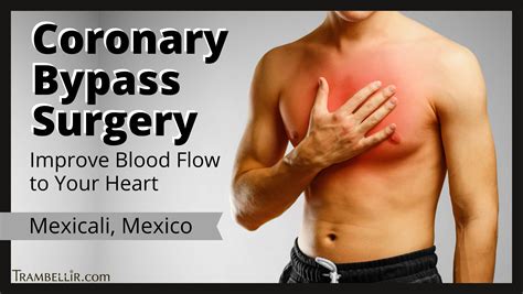Coronary Bypass Surgery Improve Blood Flow To Your Heart Trambellir