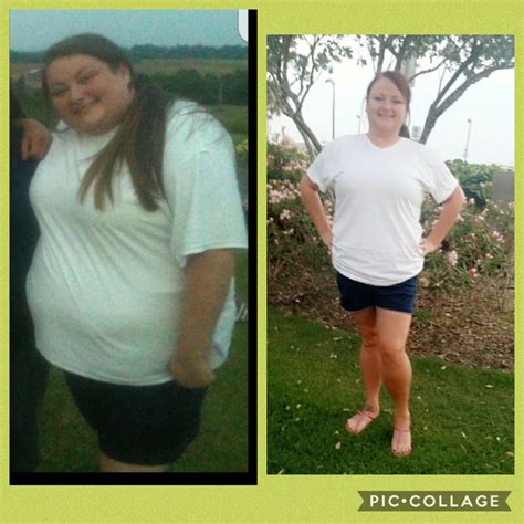 The most common funny gastric bypass material is wood. Success Stories | Georgetown Bariatrics & Advanced ...
