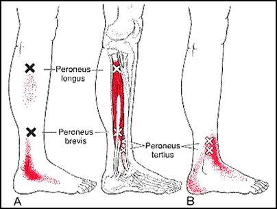 Connecting the outside of your foot to the peroneus longus and brevis muscles in your lower leg. triggerpoint peroneus | Расслабление мфр и стретч ...