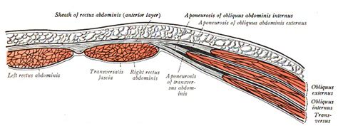 Rectus Abdominis Hematoma: Symptoms & Treatment | Study.com