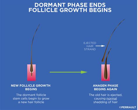 Four Stages Of The Hair Growth Cycle Hair Growth Cycl