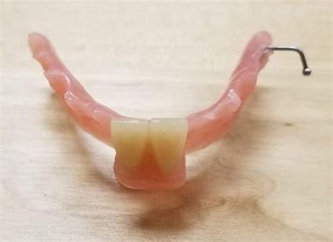 Flipper Partial Cae Dental