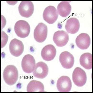 When there is an injury to a blood vessel or tissue and bleeding a high platelet count may be referred to as thrombocytosis. Platelets Morphology | Medical Laboratories