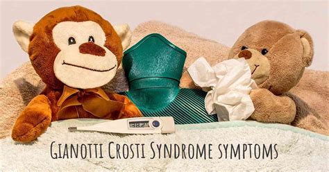 Which Are The Symptoms Of Gianotti Crosti Syndrome