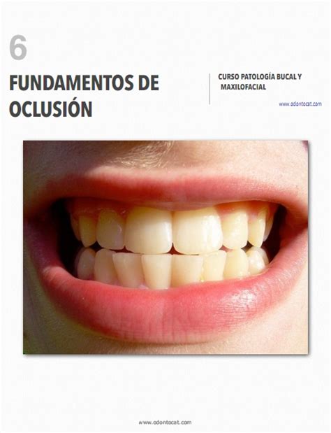 Odontocat Curso Online De Patología Bucal Y Maxilofacial