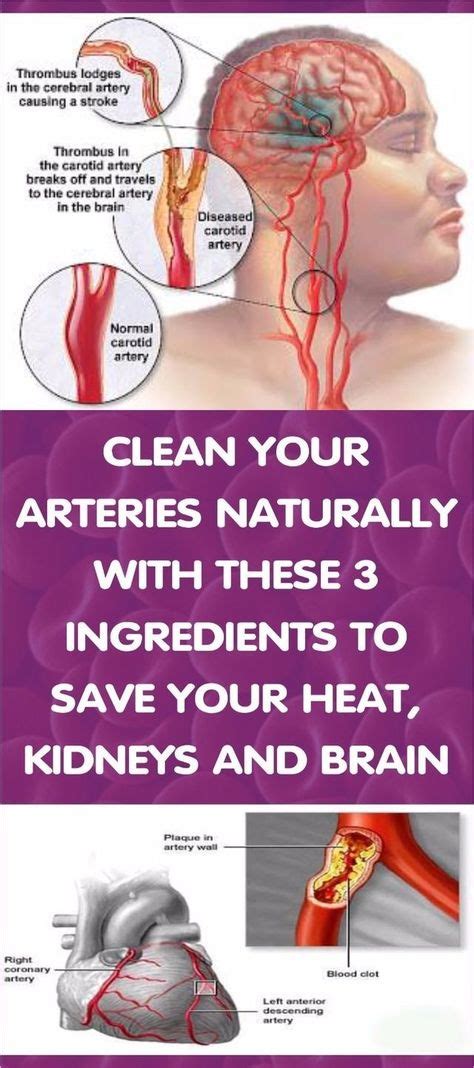 how to clean out plaque in arteries 3 ingredients mixture health