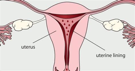 10 cara melancarkan haid yang tidak teratur secara alami. Senang Hamil: Petua 'Memaksa' Darah Haid Keluar Dengan ...