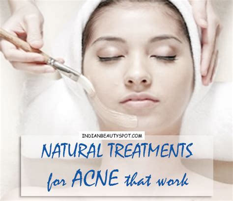5 Best Natural Treatments For Acne That Work The Indian Spot