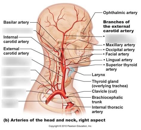 Arteries In Neck Diagram Carotid Artery Disease Clinical Features