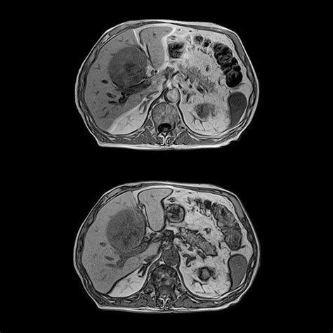 What is ct scanning of the abdomen/pelvis? CT vs MRI | What's the difference? — Thumb MRI | Michigan ...