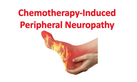 Managing Chemotherapy Induced Peripheral Neuropathy In Adult Cancers