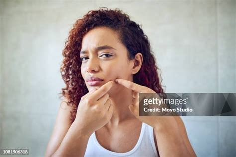 Woman Popping Pimple Photos And Premium High Res Pictures Getty Images