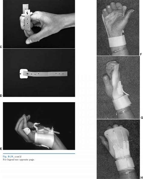 Determine The Surface For Splint Application Extremity Splinting