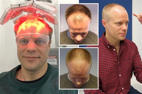 Bbc Weatherman Simon King Shows Off New Do After Getting Hair