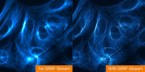 Andor´s Ixon Srrf Stream Super Resolution Microscopy Camera 2017