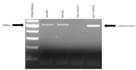 The pcr test can react to other coronaviruses. Homemade PCR Test for Mycoplasma Contamination