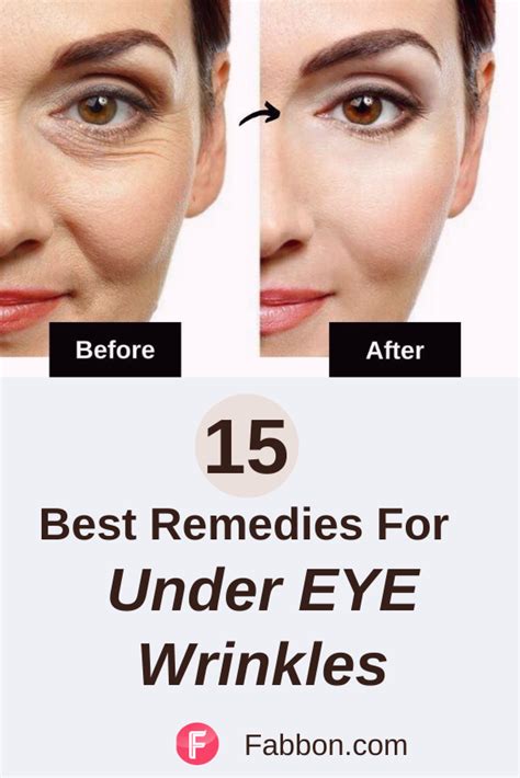 15 Most Effective Home Remedies For Under Eye Wrinkles In 2021 Under