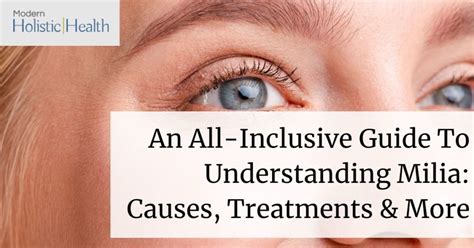 An All Inclusive Guide To Understanding Milia Causes Treatments And More