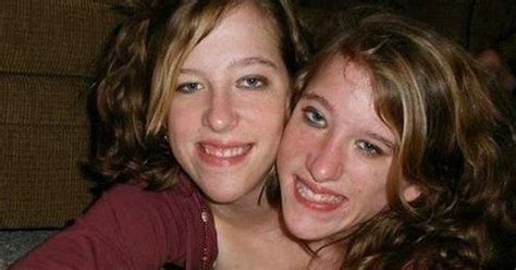 what conjoined twins abby and brittany hensel look like today newsologies daftsex hd