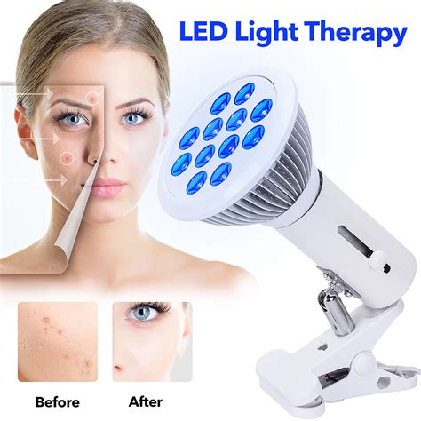 Benefits Of Blue Light Therapy Devices Lukirch