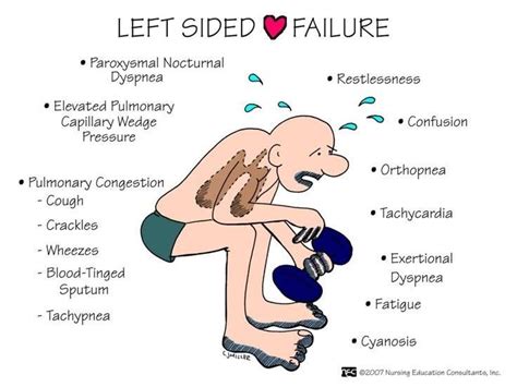 Left Sided Heart Failure Nursing Mnemonics Nursing Students Nursing