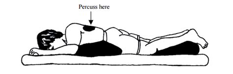 Reviewed by superteametor on juni 16. Chest physiotherapy age 2 and older