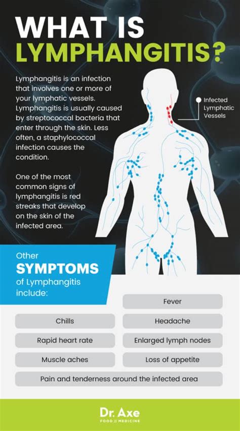Lymphangitis Signs 7 Natural Treatments For Symptoms Dr Axe