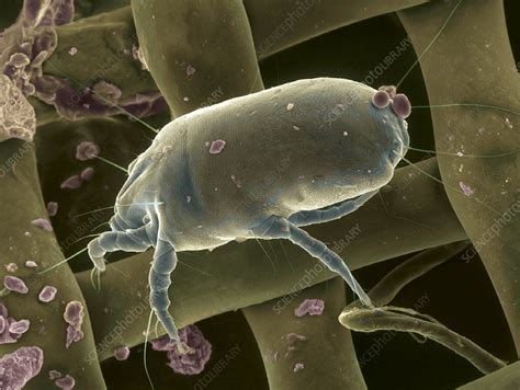 Dust Mite Sem Stock Image C0485151 Science Photo Library