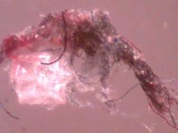 How many of you regularly take stimulants? morgellons.jpg
