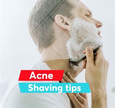 How To Shave With Acne 8 Dermatologist Tips Mdacne
