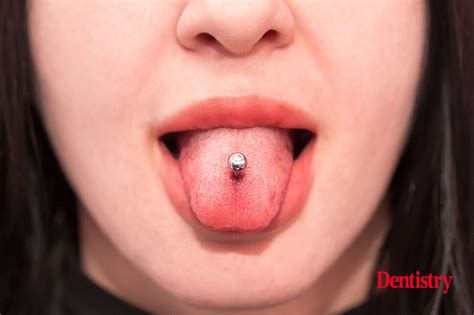 Tongue And Lip Piercings May Damage Teeth And Gums Dentistry