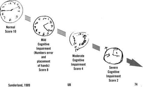 © 2008 general reinsurance corporation 18 clock drawing test scoring (10 points) • correctly placed numerals: "Alzheimer y el Cuidador", lo que debemos saber