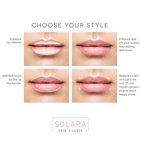 A Great Little Graph Showing Some Different Options On Lip Fillers