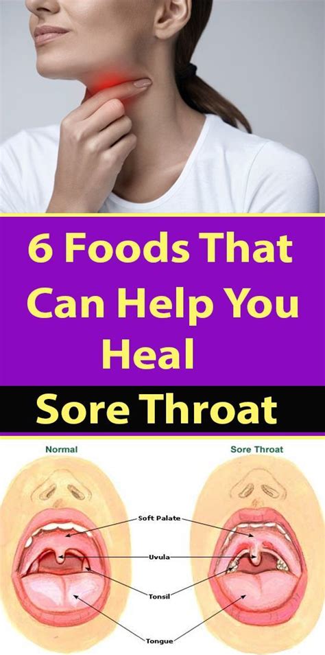 A sore throat can make it difficult to eat and drink. 6 Foods That Can Help You Heal Sore Throat | Foods for ...