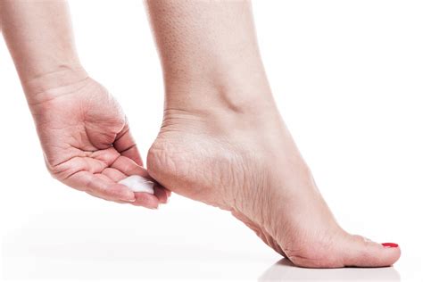 How To Get Rid Of Dry Skin On Feet Causes And Treatment Mamabella