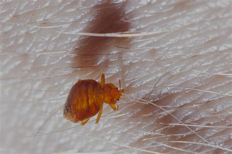 Bed Bug Bites And How To Treat Them Pest Control Guelph