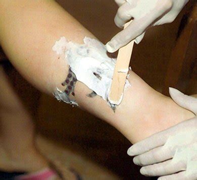 Best overall tattoo removal cream tricloroacetic acid by repare skincare 2. Tattoo Removal Cream: The Future of Tattoo Removal?