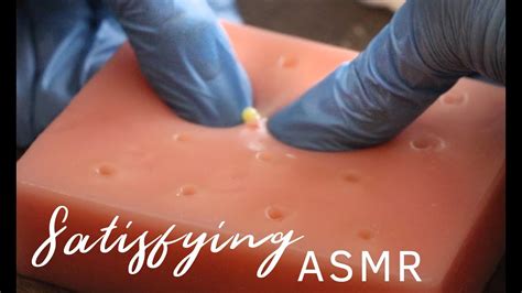 Satisfying Pimple Popping Asmr Video Youtube