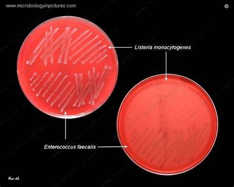 Appearance Of Listeria Monocytogenes And Enterococcus Faecalis Growth