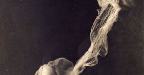 Photo Of A Spirit Medium With Ectoplasm Albert Von Schrenck Notzing