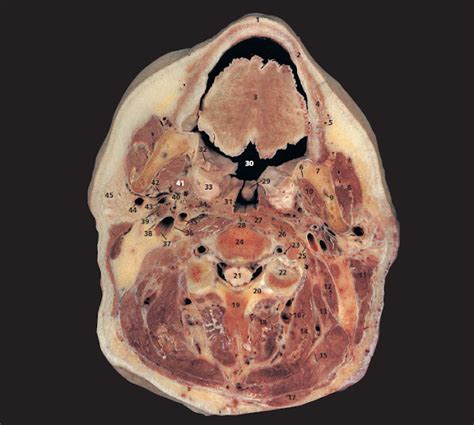 Head sectional anatomy