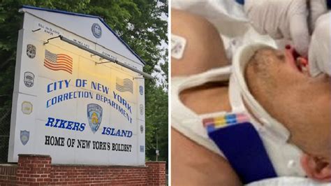 Correction Officer At Rikers Has Teeth Knocked Out After Attacked By